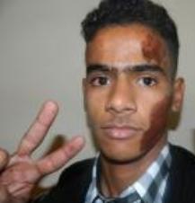 deihan-anas-bal-lah-albuhali-saharaui-menor-de-edad-agredido-por-las-fuerzas-de-ocupacion-de-marruecos
