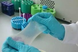 El primer trasplante de piel en España se realizó hace más de 14 años Piel